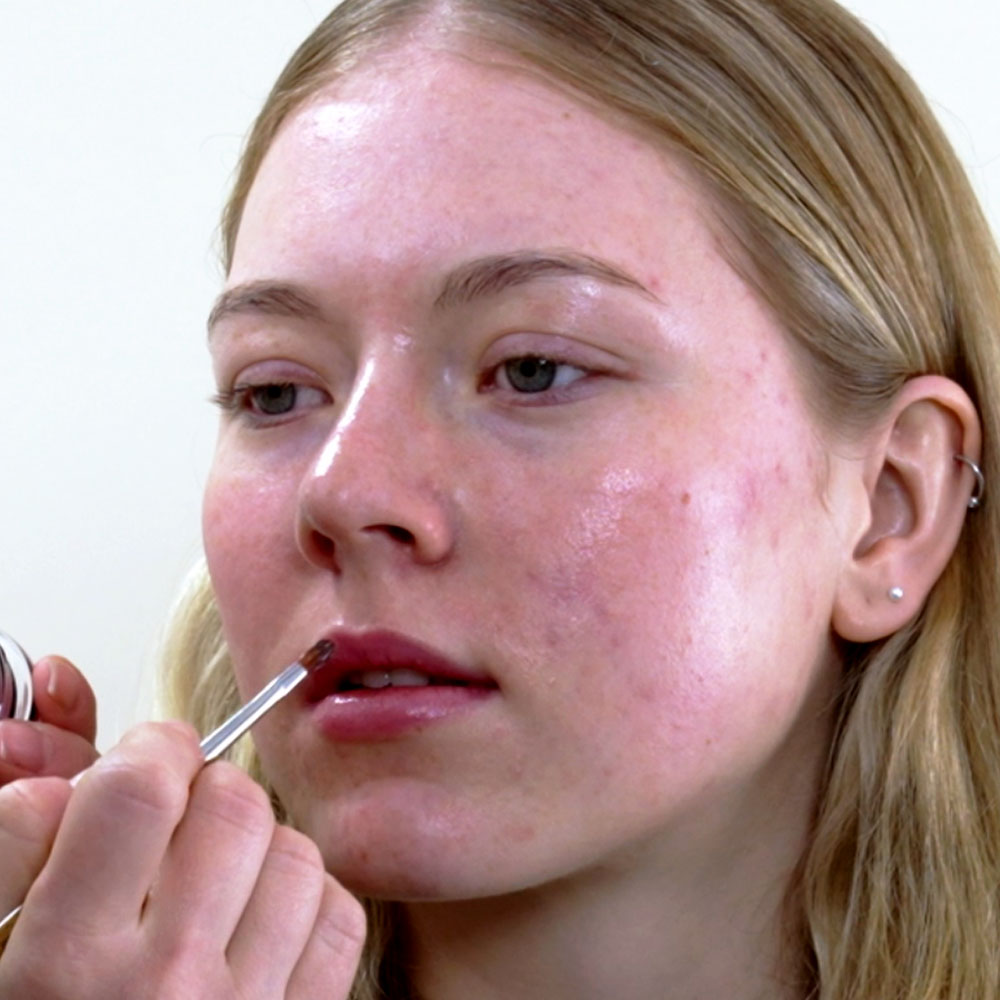 Lip Treatment